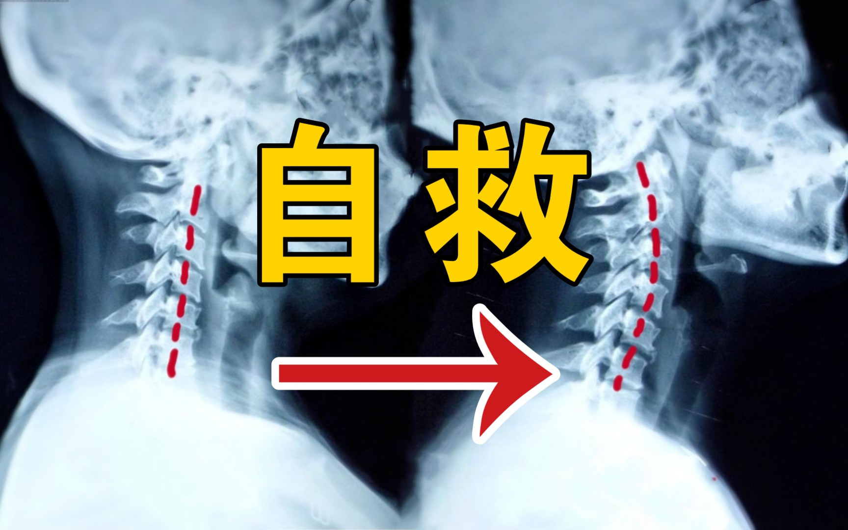 颈椎疼怎么缓解-颈椎疼太要命？试试这些方法，让你的脖子不再僵硬